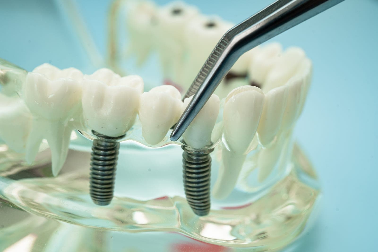 6 Technologies a Modern Dental Clinic in Albania Should Have