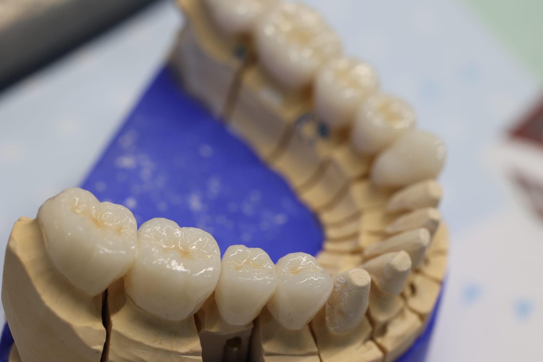 The in-house dental laboratory at Dental Med Austria, where each full-arch bridge is milled and finished by the clinic's own technicians