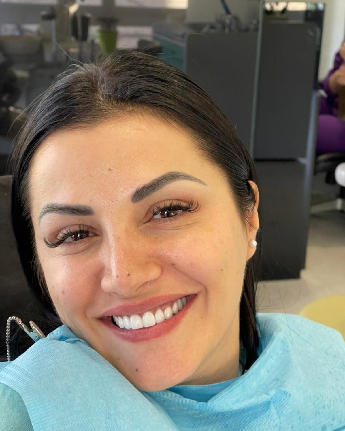 Smile transformation at Dental Med Austria, patient result 22