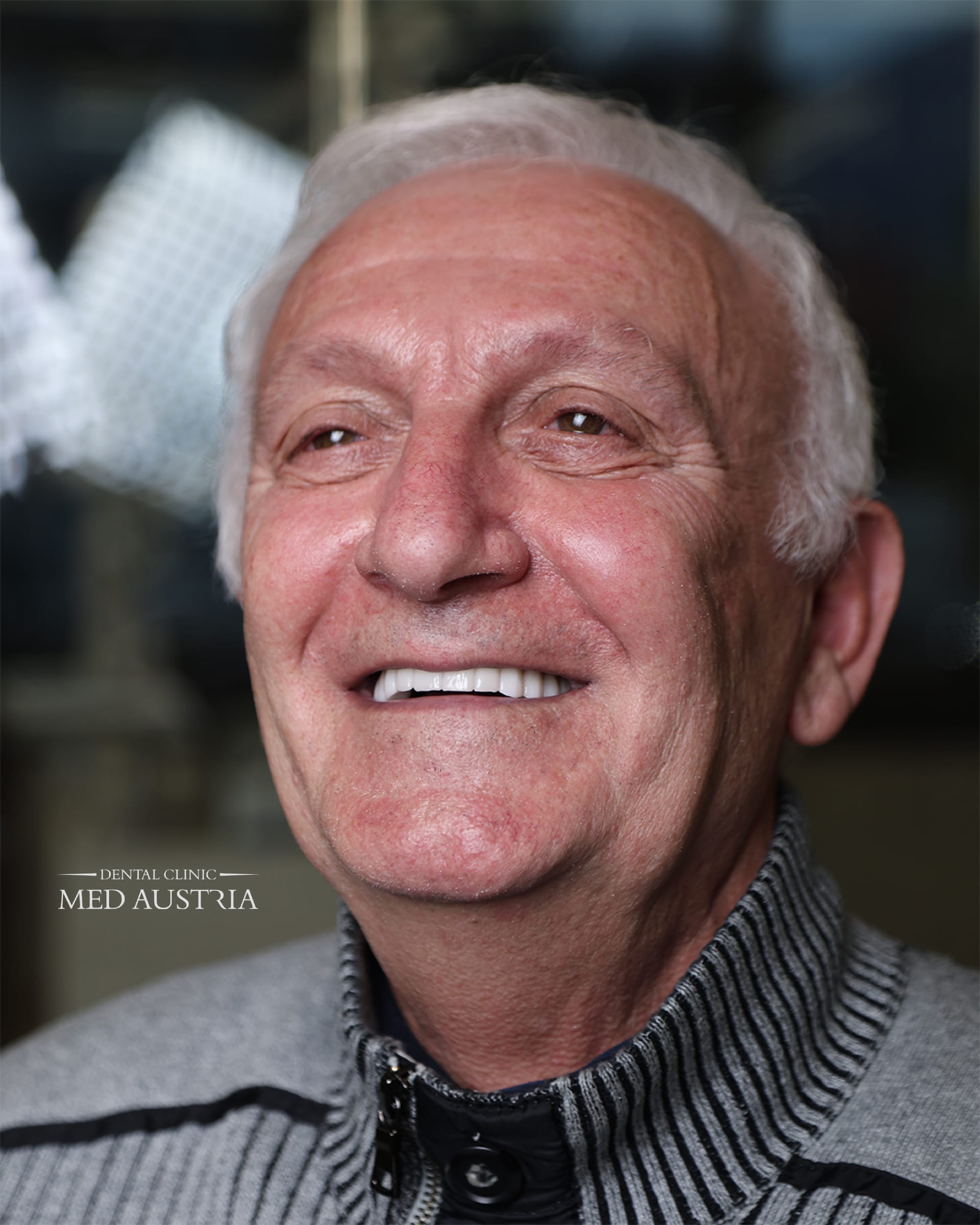 Smile transformation at Dental Med Austria, patient result 8