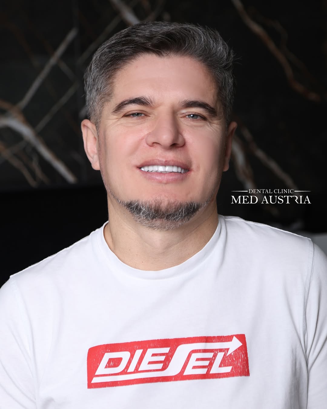 Smile transformation at Dental Med Austria, patient result 14