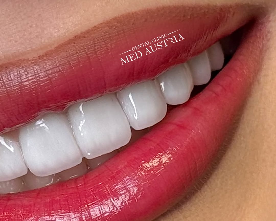 A real patient result at Dental Med Austria