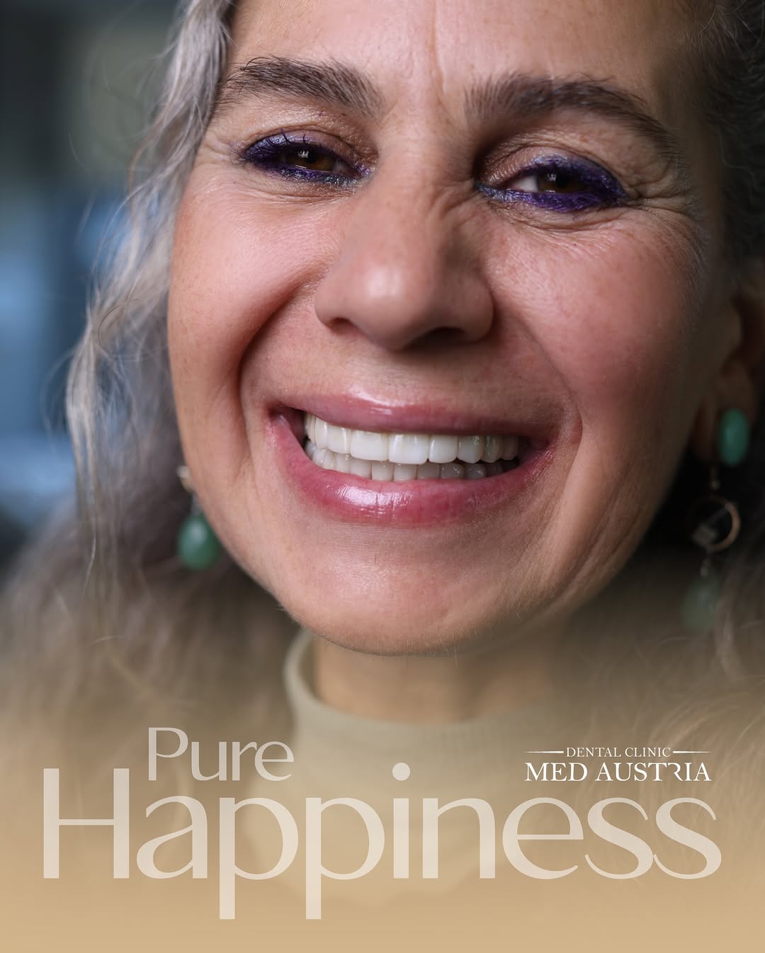 Smile transformation at Dental Med Austria, patient result 25