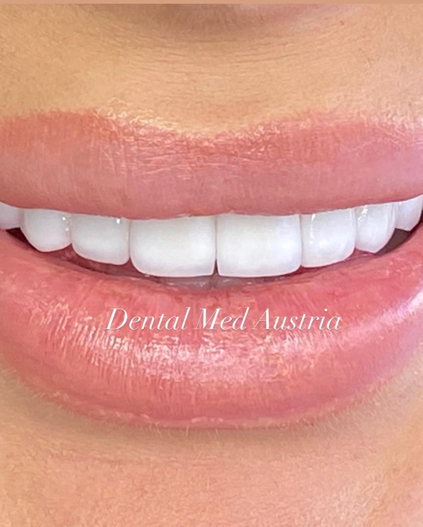 A Dental Med Austria patient smiling with confidence after treatment in Tirana