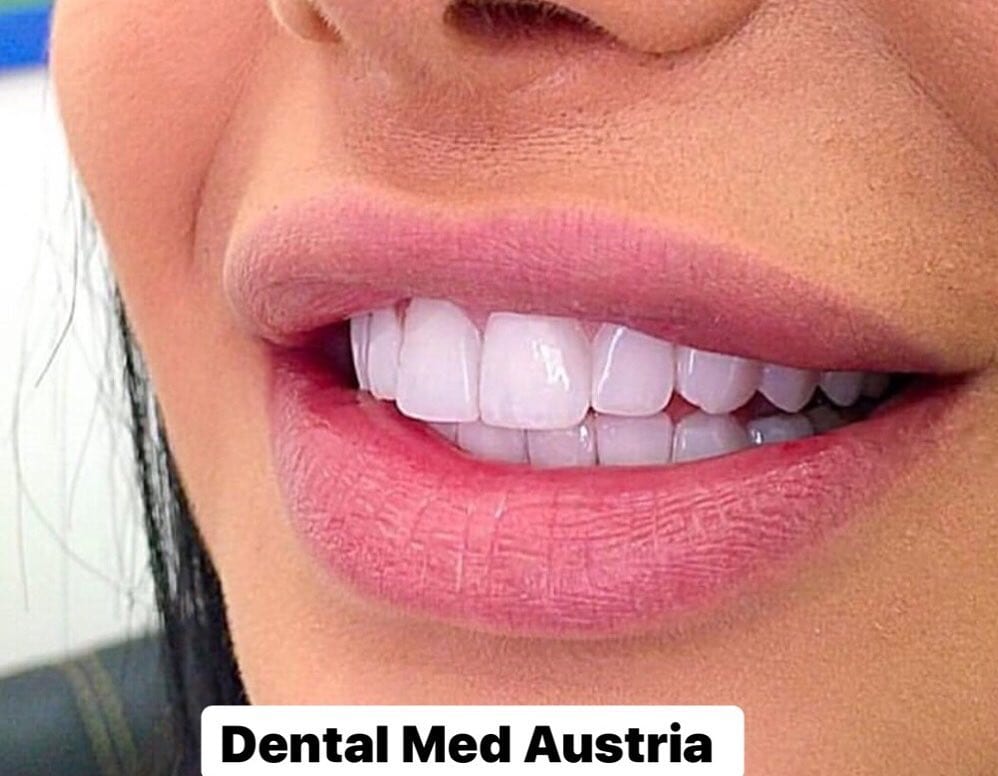 A real patient result at Dental Med Austria
