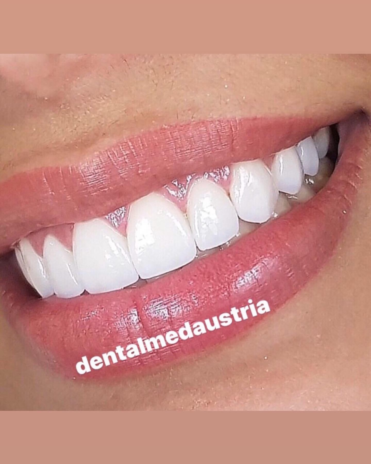 A real patient result at Dental Med Austria