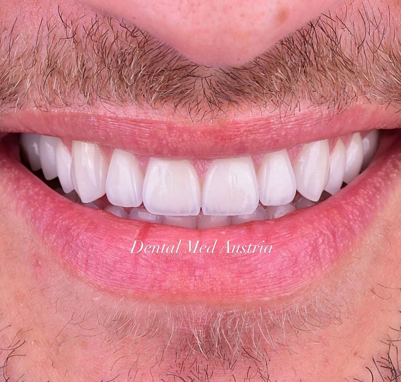 A real patient result at Dental Med Austria