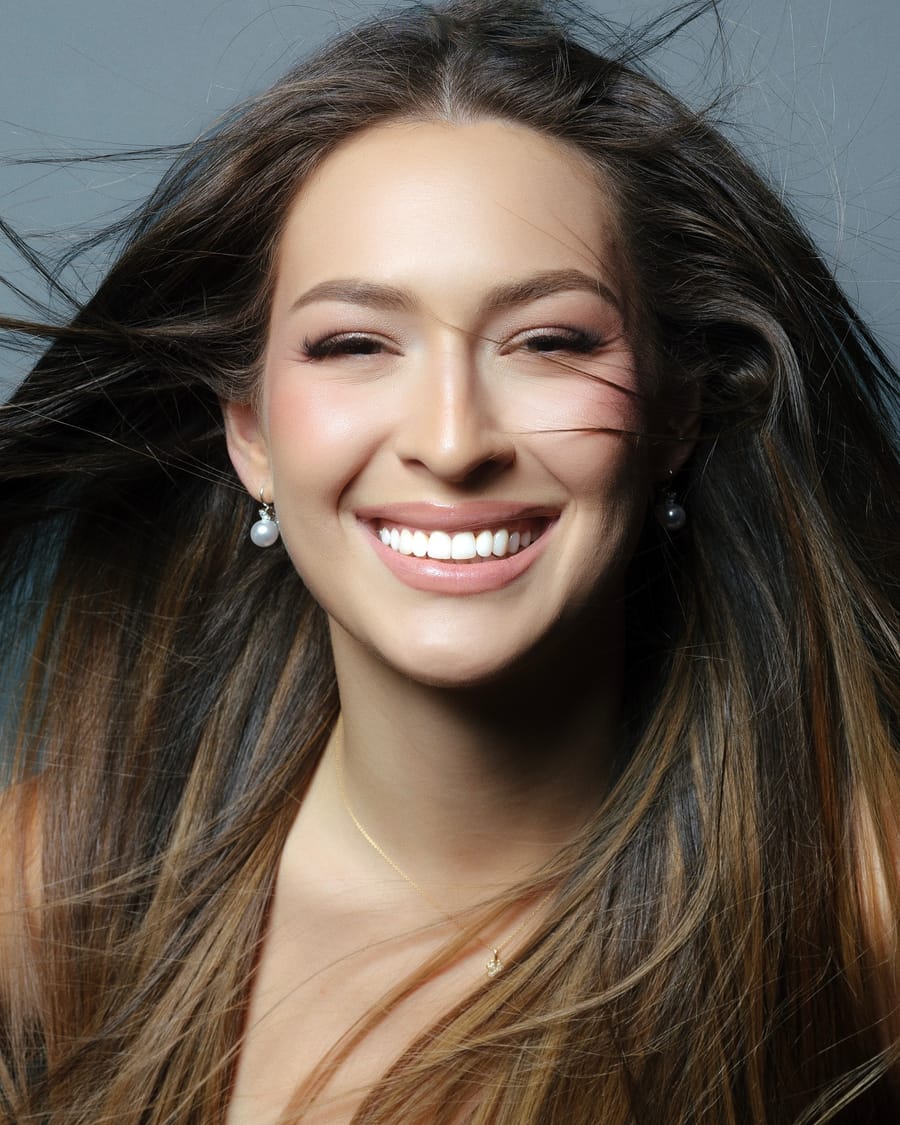 Franceska Murati, Model & Big Brother VIP Star, smile by Dental Med Austria