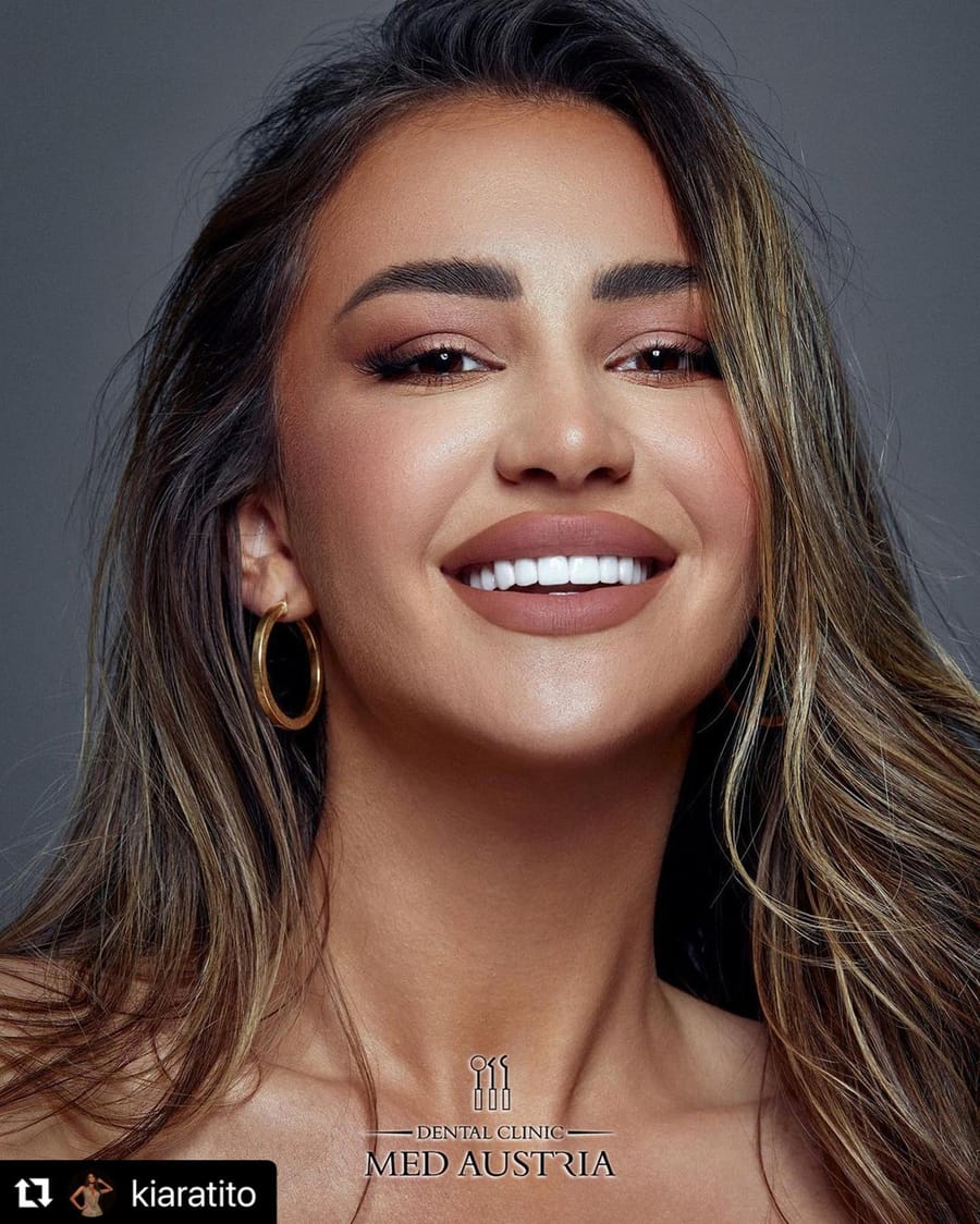 Kiara Tito, TV Host, smile by Dental Med Austria